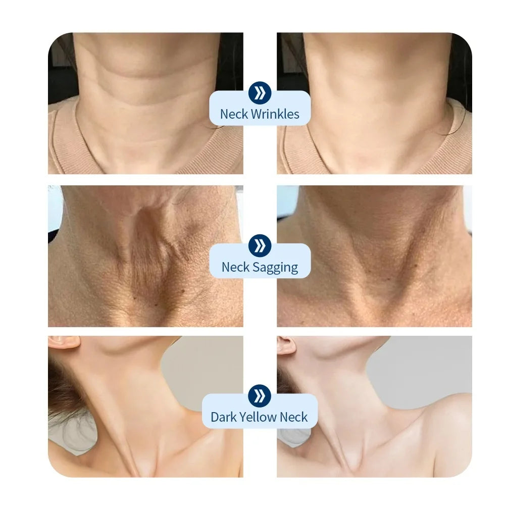 Red Light Therapy skin regeneration technology